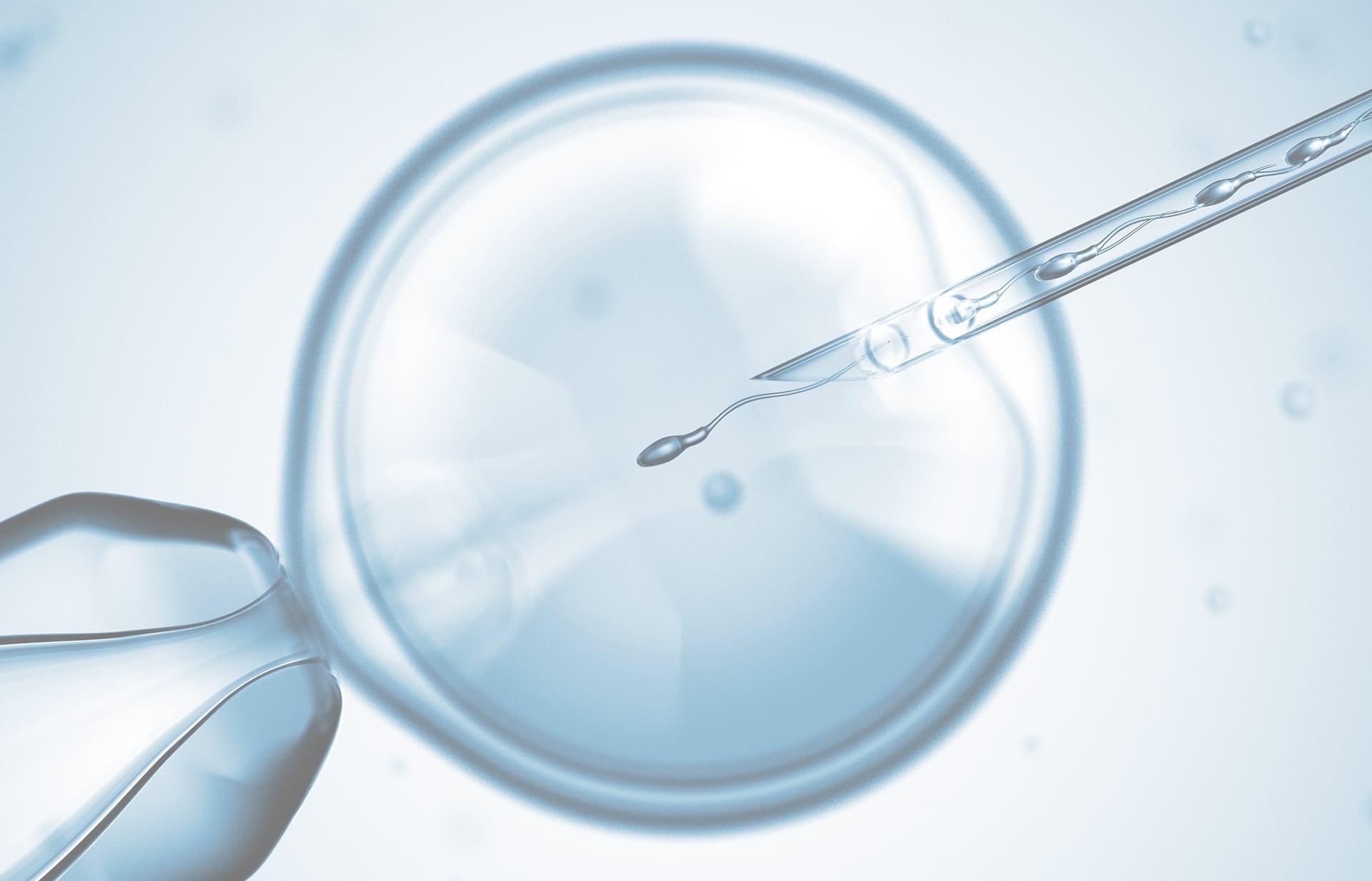 Injeção Intracitoplasmática de Espermatozoide (ICSI) Dra. Fernanda