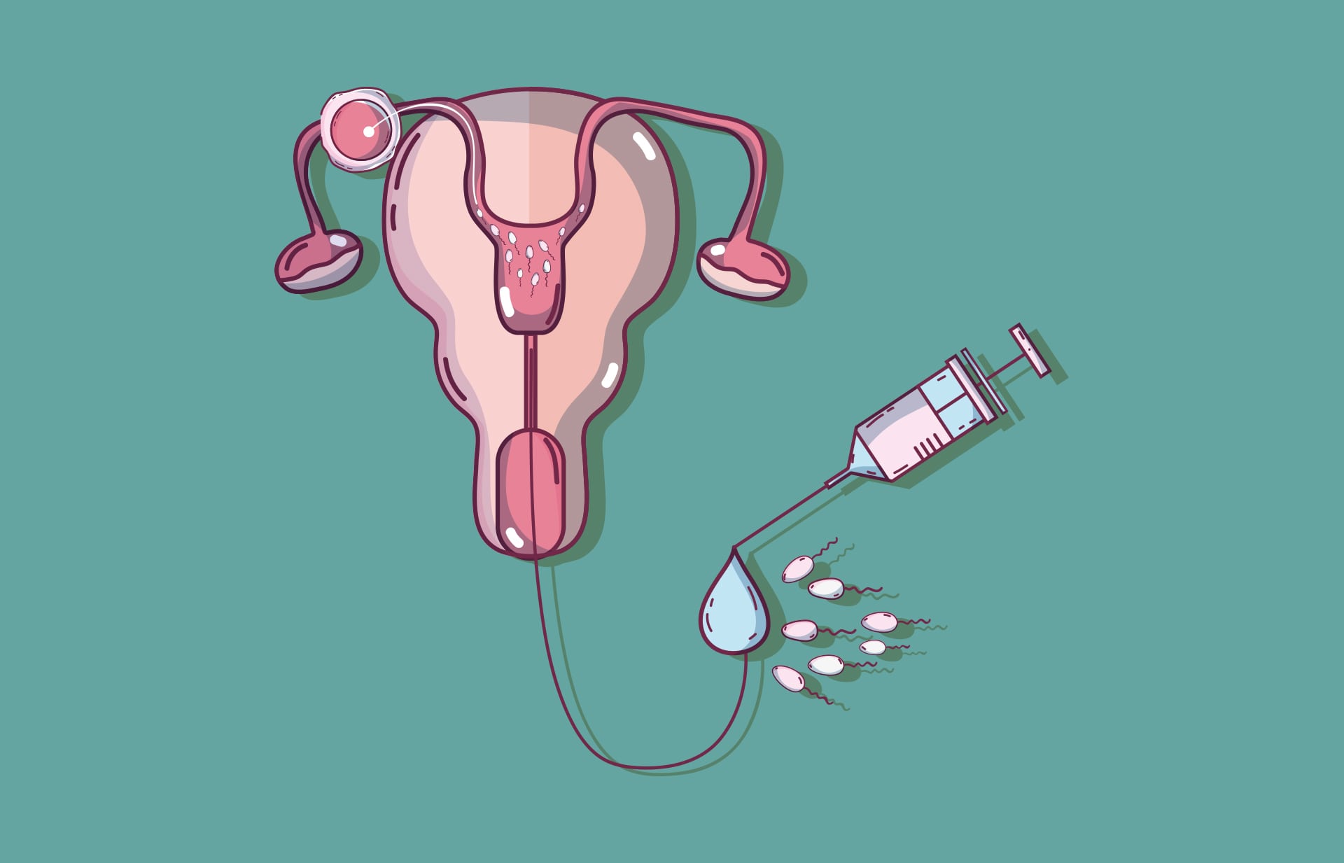 Como é realizada a inseminação artificial