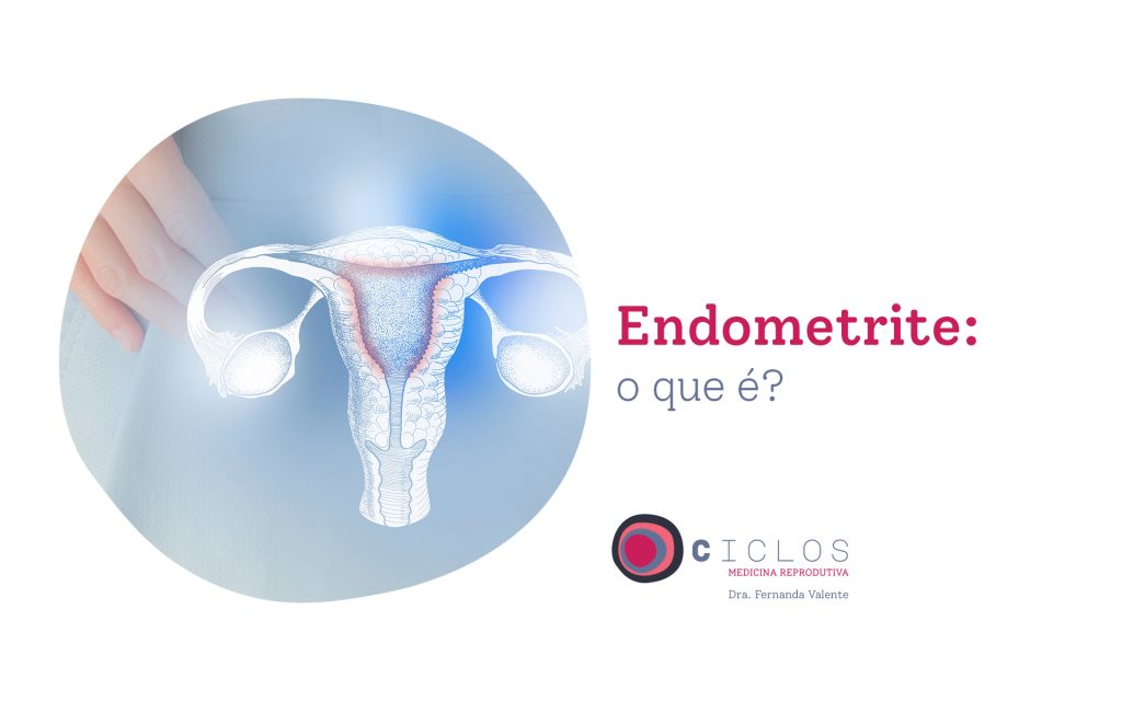 Endometrite e falha de implantação: existe relação?