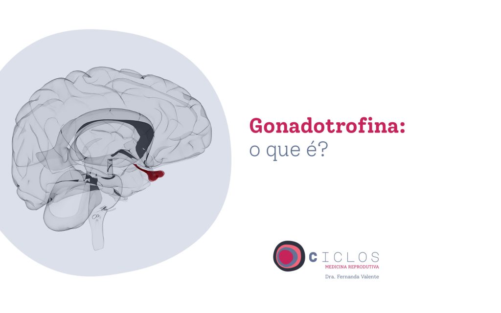 Hidrossalpinge: saiba tudo sobre a doença