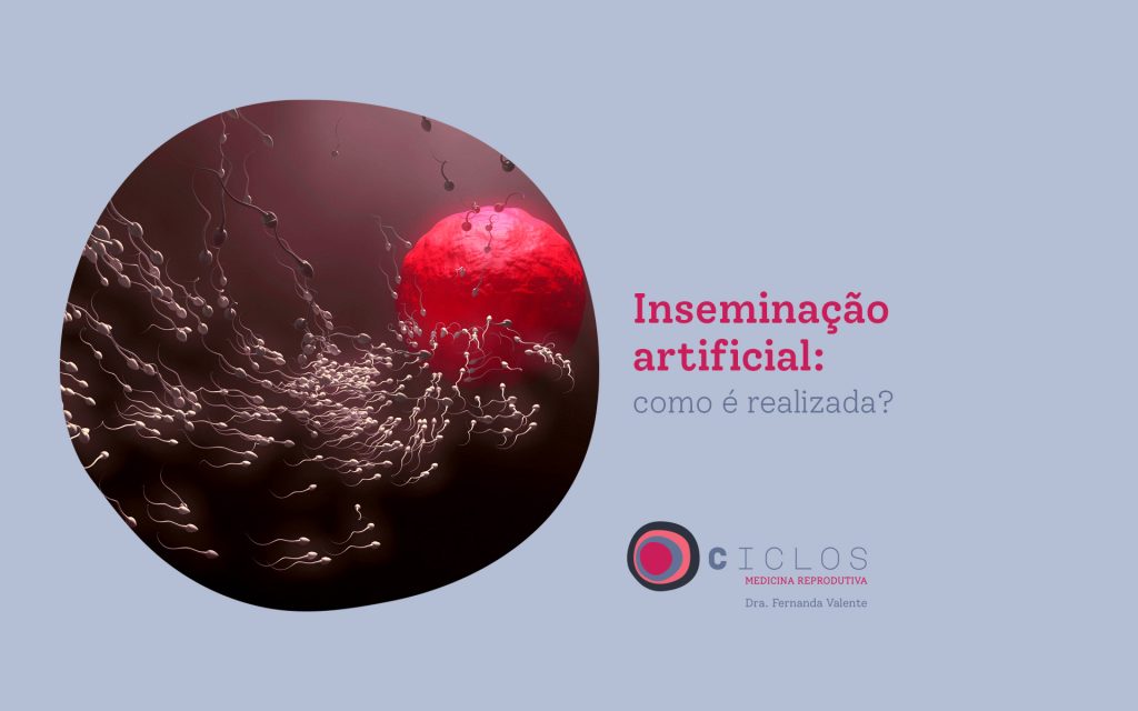 Hidrossalpinge: saiba tudo sobre a doença